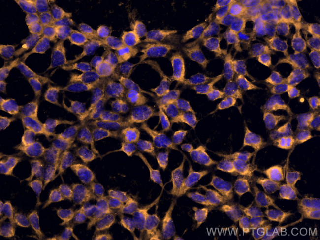 MTHFD1 Antibody in Immunocytochemistry (ICC/IF)