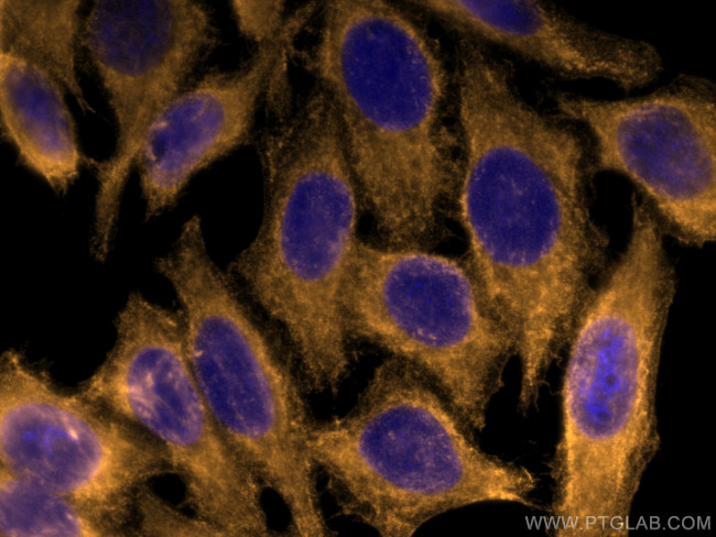 FAH Antibody in Immunocytochemistry (ICC/IF)