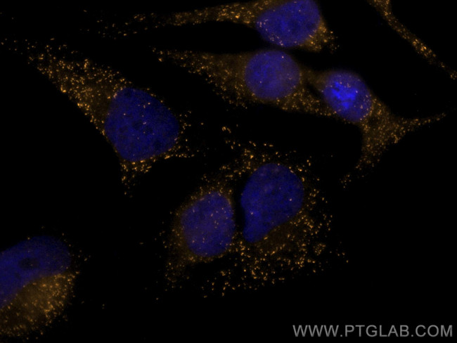 PEX14 Antibody in Immunocytochemistry (ICC/IF)