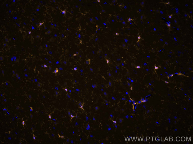 IBA1 Antibody in Immunohistochemistry (PFA fixed) (IHC (PFA))