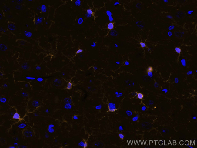 IBA1 Antibody in Immunohistochemistry (PFA fixed) (IHC (PFA))