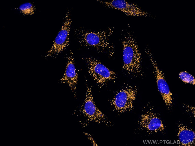 PEX14 Antibody in Immunocytochemistry (ICC/IF)