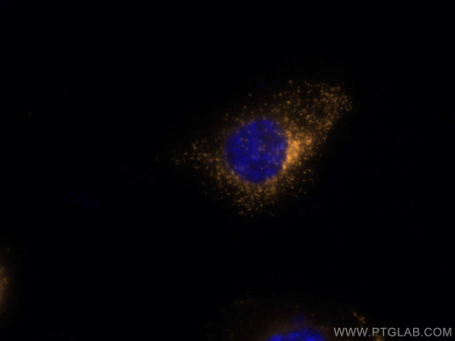 TIP47 Antibody in Immunocytochemistry (ICC/IF)