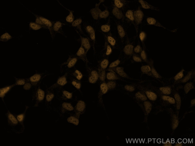 c-MYC Antibody in Immunocytochemistry (ICC/IF)