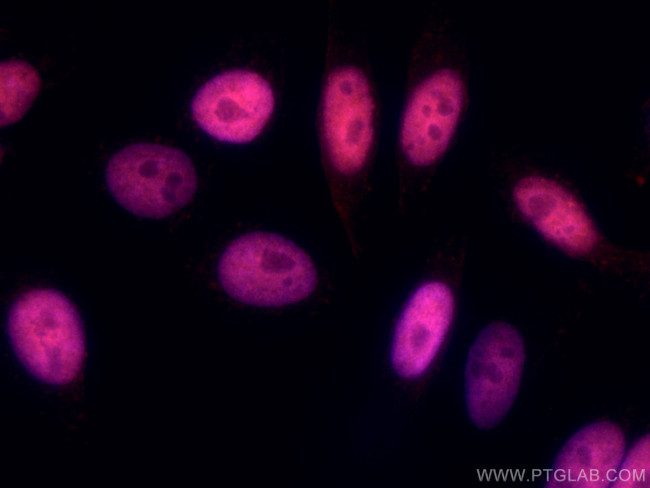 MECP2 Antibody in Immunocytochemistry (ICC/IF)