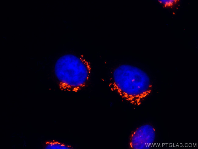 GOLGA2/GM130 Antibody in Immunocytochemistry (ICC/IF)