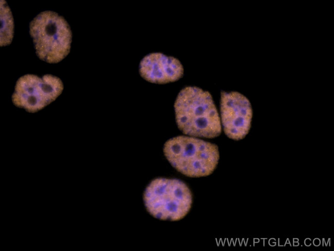 FUS/TLS Antibody in Immunocytochemistry (ICC/IF)