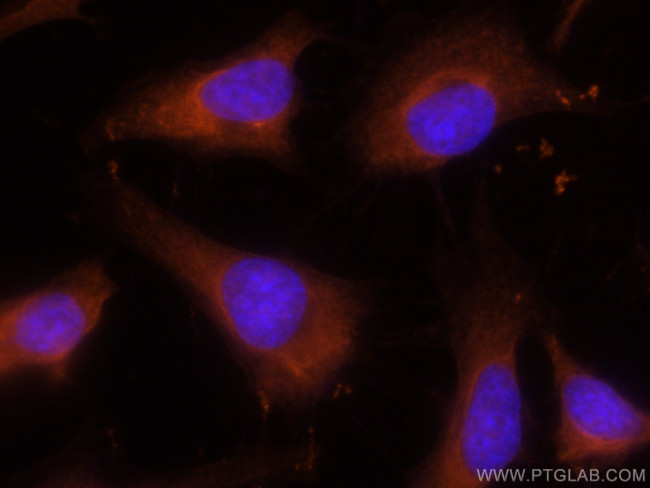 FABP5 Antibody in Immunocytochemistry (ICC/IF)