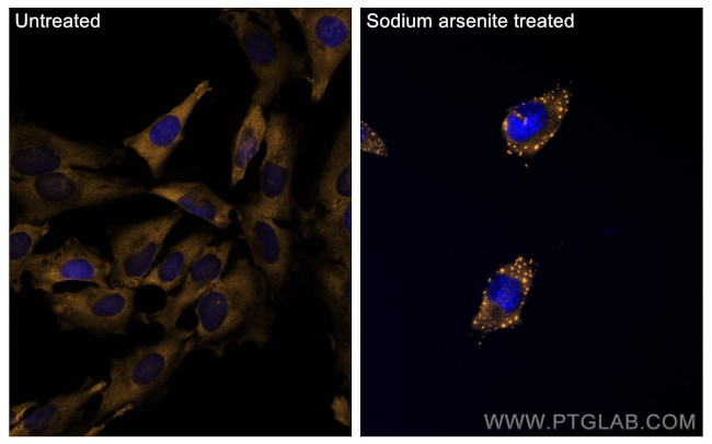 G3BP1 Antibody in Immunocytochemistry (ICC/IF)