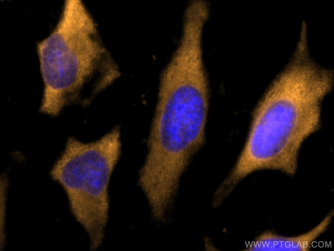 LDHB Antibody in Immunocytochemistry (ICC/IF)