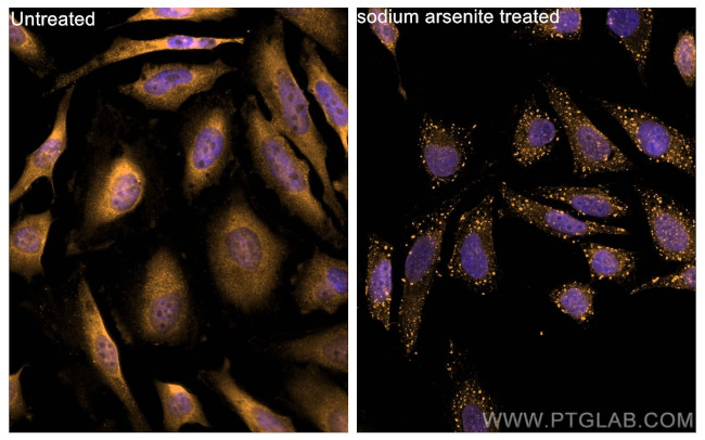 G3BP2 Antibody in Immunocytochemistry (ICC/IF)