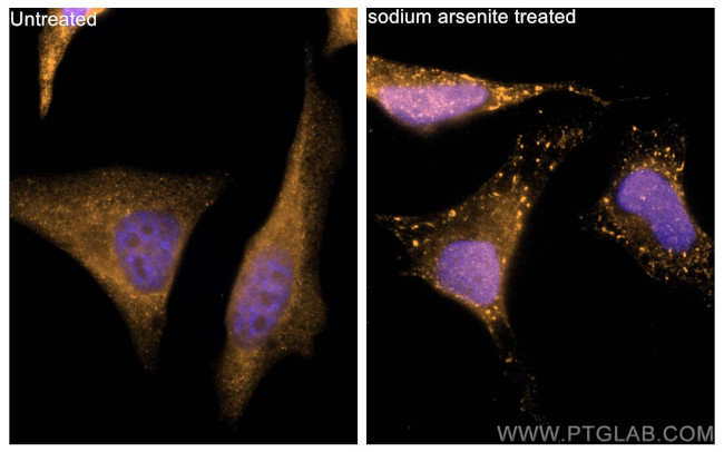 G3BP2 Antibody in Immunocytochemistry (ICC/IF)