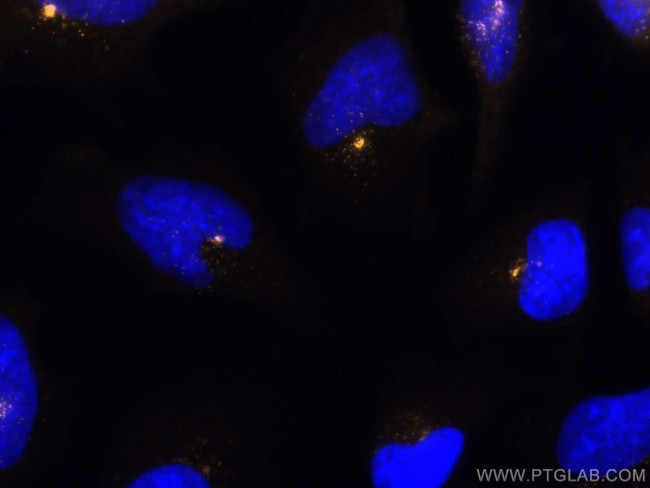 PCM1 Antibody in Immunocytochemistry (ICC/IF)