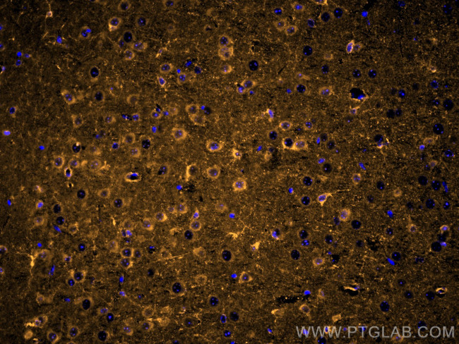 MARCKS Antibody in Immunohistochemistry (Paraffin) (IHC (P))