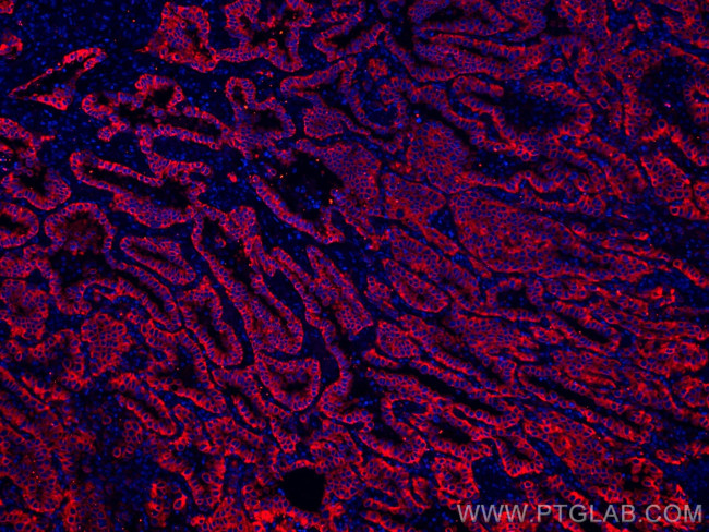 pan-keratin Antibody in Immunohistochemistry (Paraffin) (IHC (P))