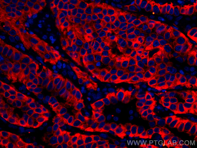 pan-keratin Antibody in Immunohistochemistry (Paraffin) (IHC (P))