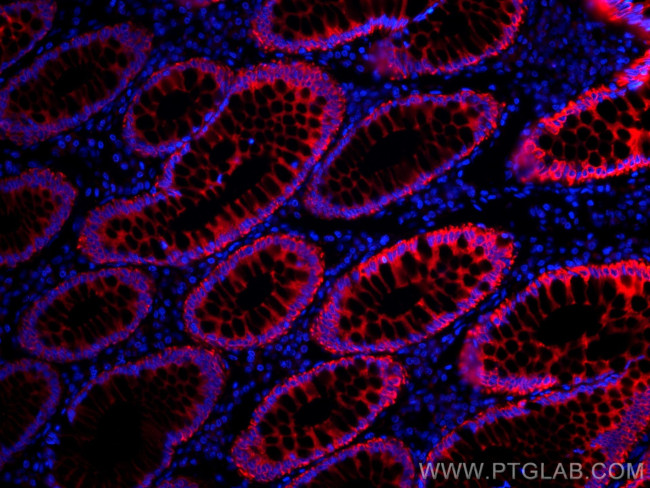 pan-keratin Antibody in Immunohistochemistry (Paraffin) (IHC (P))