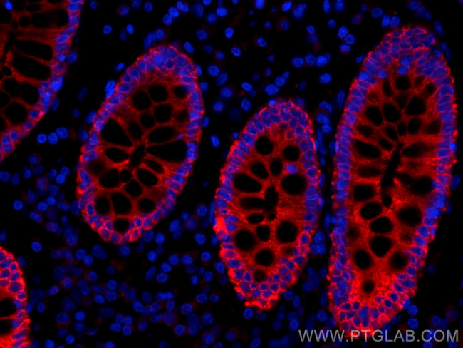 pan-keratin Antibody in Immunohistochemistry (Paraffin) (IHC (P))