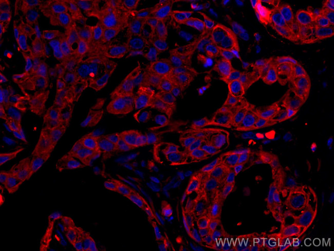 pan-keratin Antibody in Immunohistochemistry (Paraffin) (IHC (P))