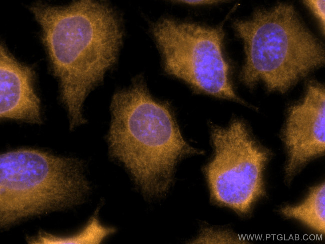 NDRG1 Antibody in Immunocytochemistry (ICC/IF)