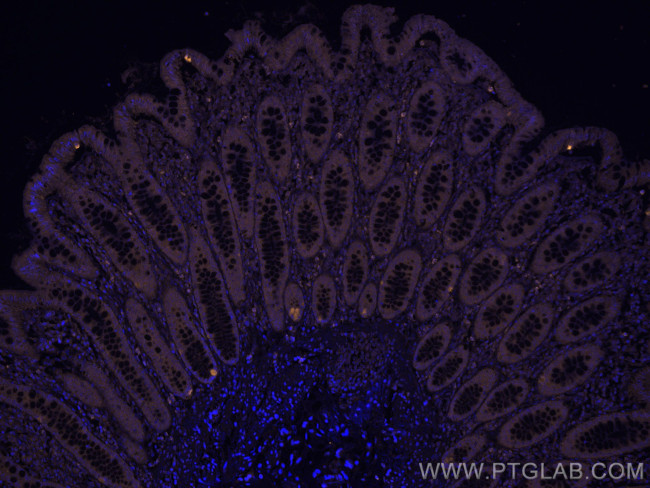 PPAR Gamma Antibody in Immunohistochemistry (Paraffin) (IHC (P))