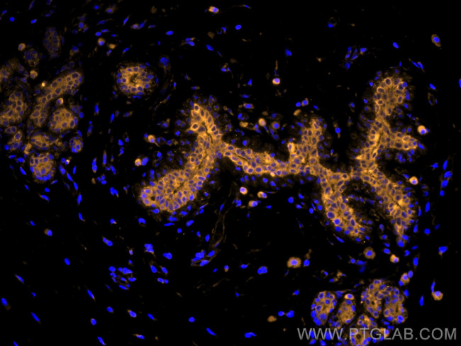 Cytokeratin 19 Antibody in Immunohistochemistry (Paraffin) (IHC (P))