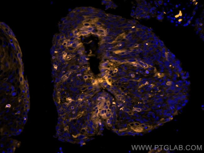 Cytokeratin 19 Antibody in Immunohistochemistry (Paraffin) (IHC (P))