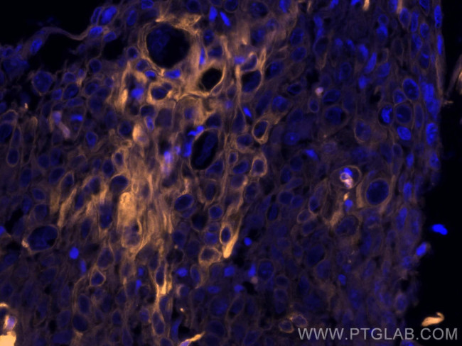 Cytokeratin 19 Antibody in Immunohistochemistry (Paraffin) (IHC (P))