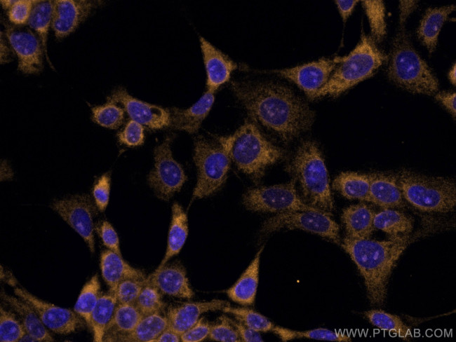 Galectin-3 Antibody in Immunocytochemistry (ICC/IF)