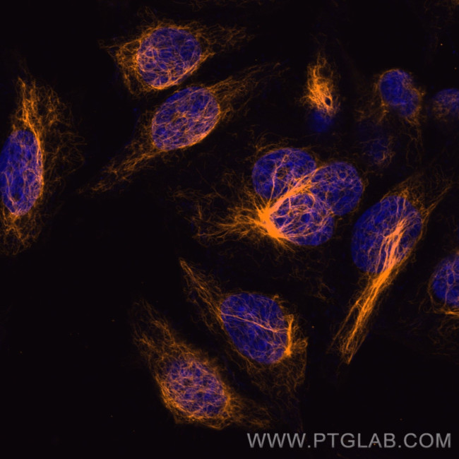 Vimentin Antibody in Immunocytochemistry (ICC/IF)