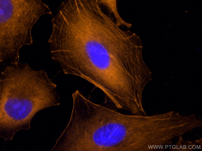 Beta Actin Antibody in Immunocytochemistry (ICC/IF)