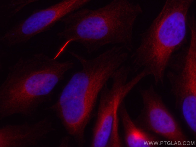 Alpha Tubulin Antibody in Immunocytochemistry (ICC/IF)