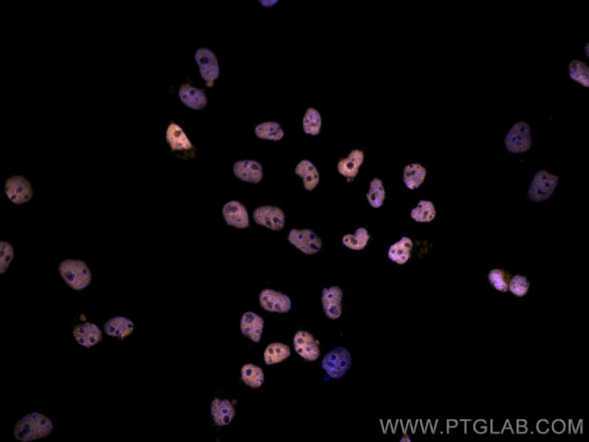 HDAC1 Antibody in Immunocytochemistry (ICC/IF)