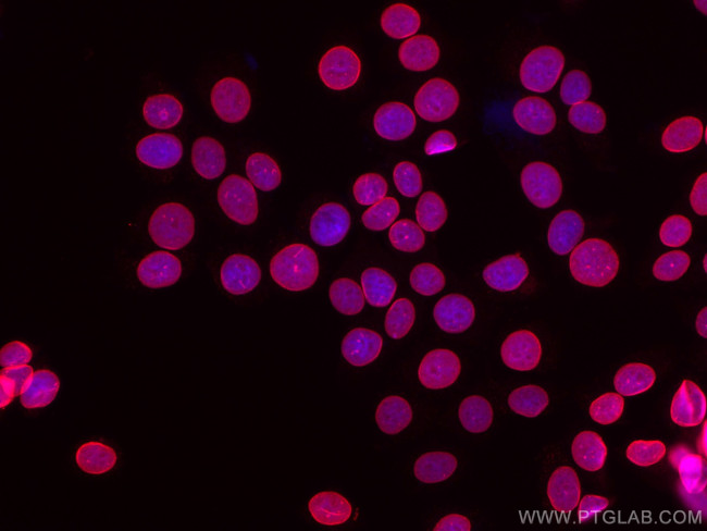 Lamin B1 Antibody in Immunocytochemistry (ICC/IF)