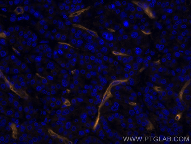 CD146/MCAM Antibody in Immunohistochemistry (Paraffin) (IHC (P))