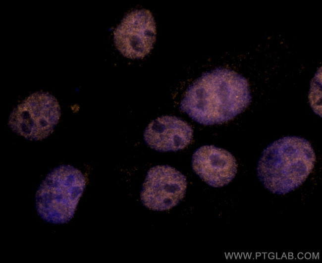 TBP Antibody in Immunocytochemistry (ICC/IF)