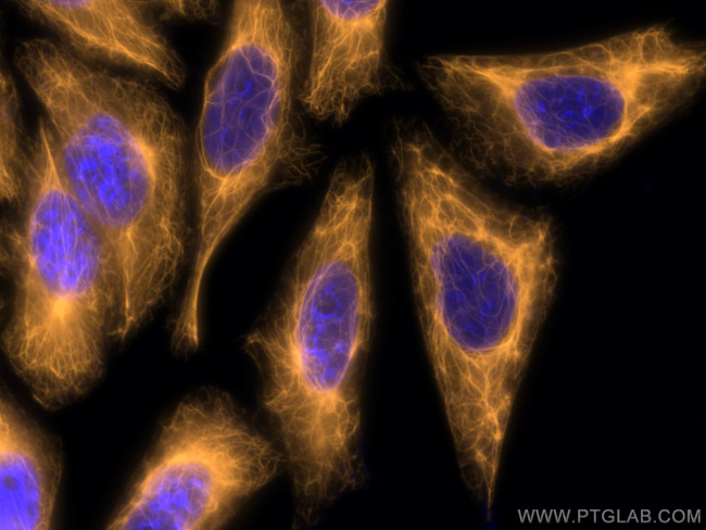 Cytokeratin 18 Antibody in Immunocytochemistry (ICC/IF)