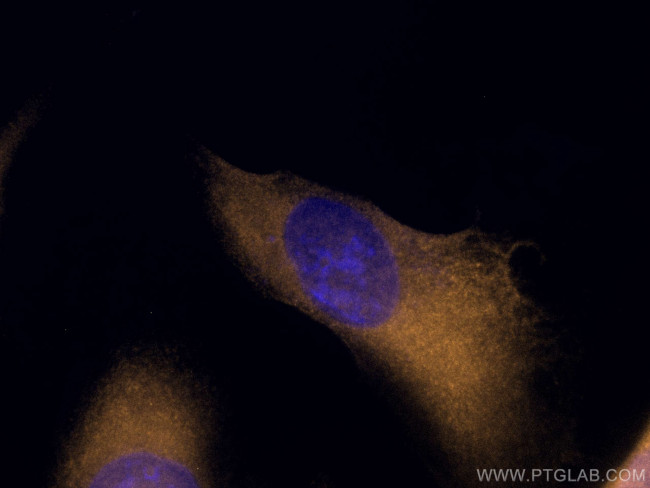 G6PD Antibody in Immunocytochemistry (ICC/IF)