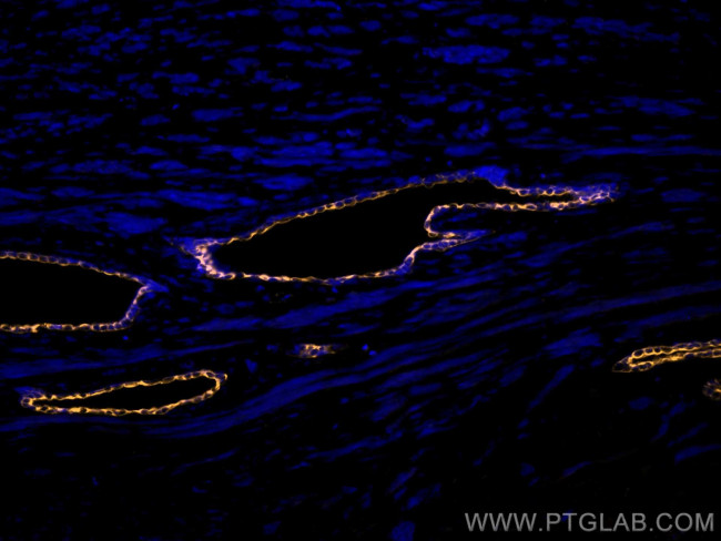 Cytokeratin 7 Antibody in Immunohistochemistry (Paraffin) (IHC (P))