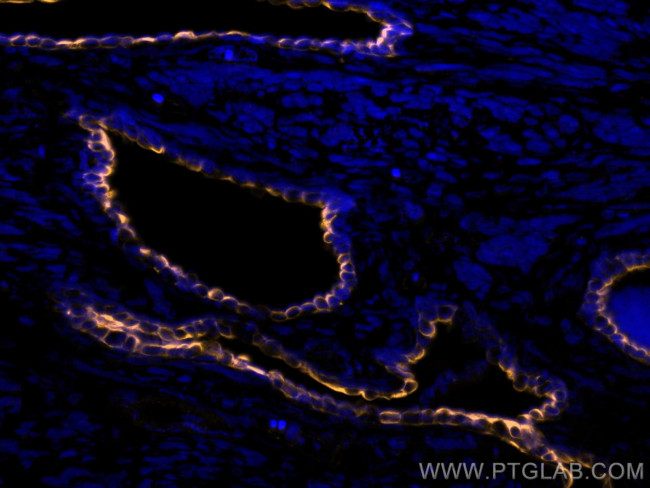 Cytokeratin 7 Antibody in Immunohistochemistry (Paraffin) (IHC (P))