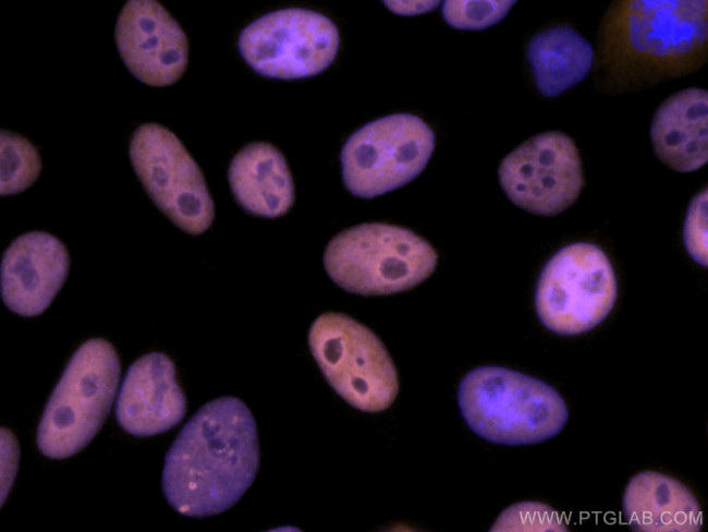 KAP1 Antibody in Immunocytochemistry (ICC/IF)