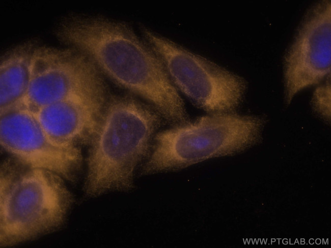 LARP1 Antibody in Immunocytochemistry (ICC/IF)