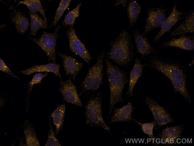 MAP2K3 Antibody in Immunocytochemistry (ICC/IF)