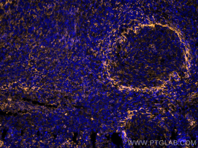 TMEM173/STING Antibody in Immunohistochemistry (Paraffin) (IHC (P))