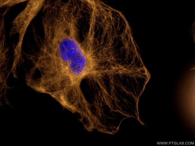 Beta Tubulin Antibody in Immunocytochemistry (ICC/IF)