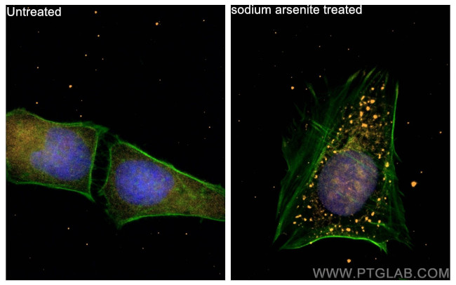 G3BP1 Antibody in Immunocytochemistry (ICC/IF)