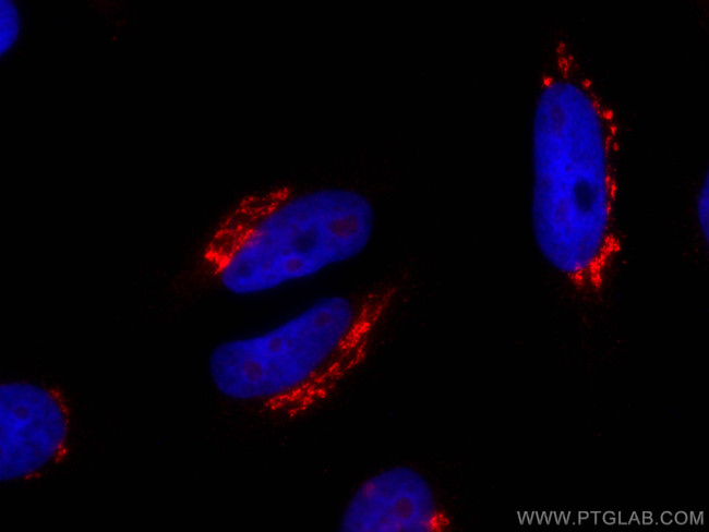 TGN46 Antibody in Immunocytochemistry (ICC/IF)