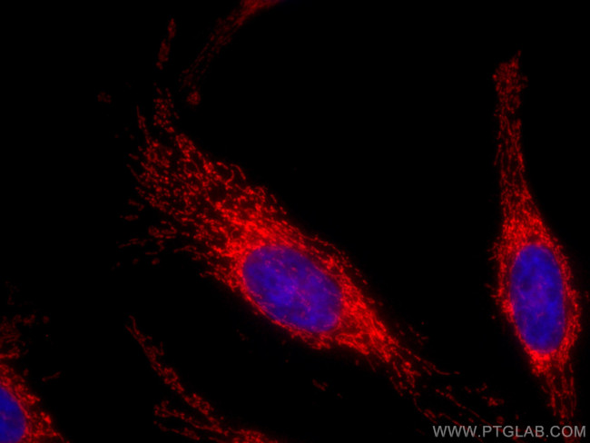 PARK2/Parkin Antibody in Immunocytochemistry (ICC/IF)