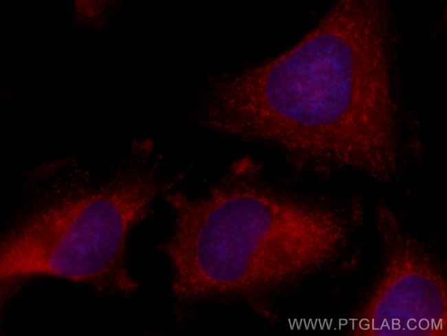 CBS Antibody in Immunocytochemistry (ICC/IF)