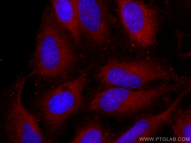 FSHR Antibody in Immunocytochemistry (ICC/IF)